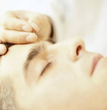 顽固性面瘫针灸多长时间,面瘫针灸怎么治疗好得快呢