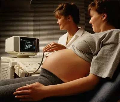 大s有癫痫还能生二胎吗,大s生二胎的时候诱发了癫痫吗