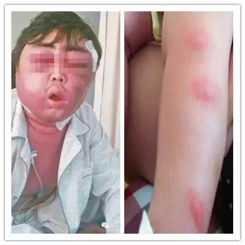 儿童驱蚊液无害,驱蚊液科普