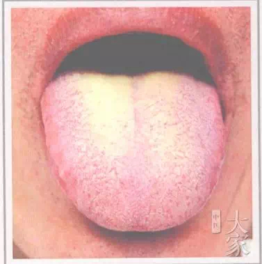 宝宝舌苔厚怎么办小妙招,宝宝舌苔厚怎么办