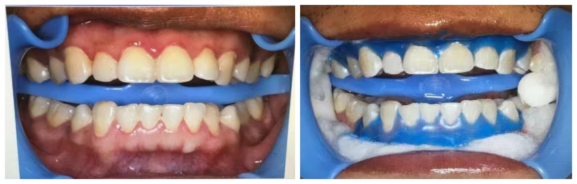 口腔专家王丽,口腔美牙仪