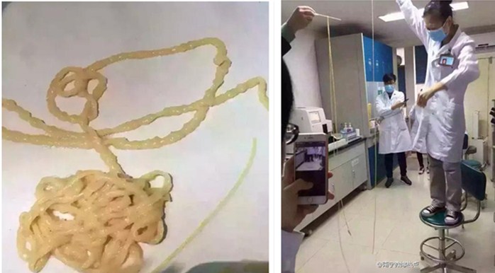 儿童寄生虫病怎么治疗效果好,儿童寄生虫怎么消灭最快