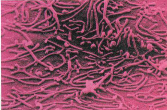 怀孕了支原体阳性怎么治疗,人类支原体阳性影响怀孕吗