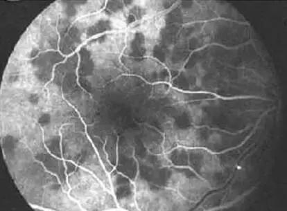 除了不锈钢还有哪些材料不生锈,不锈钢在什么情况下会生锈