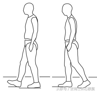 acl前叉韧带恢复训练动作,acl前交叉韧带重建第9天