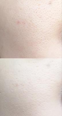 粉底液太干加柔肤乳可以吗,粉底液太干在里面加点水乳