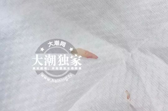 6岁小孩长出28颗牙齿,两排牙齿的孩子图片