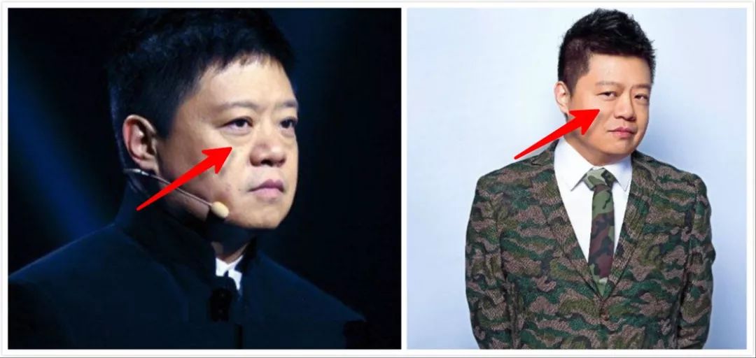 妈妈们适合什么眼霜,给妈妈买的眼霜