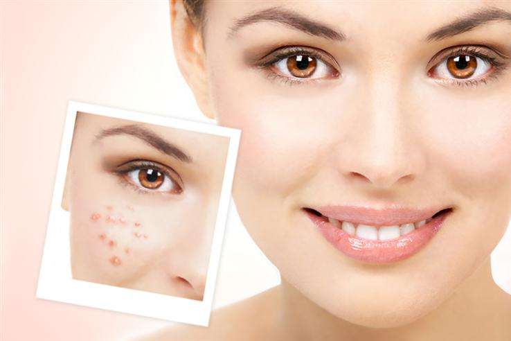 下巴总是反复长痘是哪个器官不好,脸颊反复长痘上医院看了一直不好