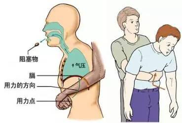 小鱼刺卡喉咙自救有妙招不去医院,2岁宝宝鱼刺卡喉咙自救有妙招