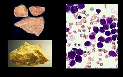 朱砂中毒解毒,古代朱砂有毒吗