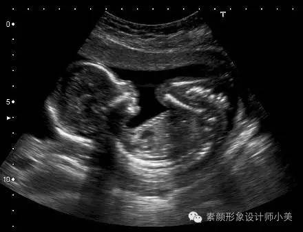 孕育课堂,孕育课堂爆款视频