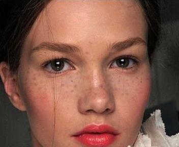 淡化斑点你还在为斑点烦恼吗,斑点的原因和改善方法