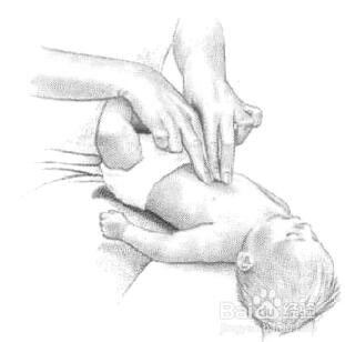 气管误吸异物怎么处理,如何防止孩子误吸异物