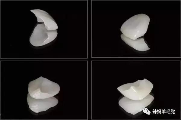 美白牙齿笑容自信,去皱美白牙齿小窍门