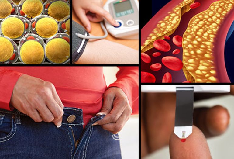 代谢综合征通过运动能治愈吗,代谢综合征