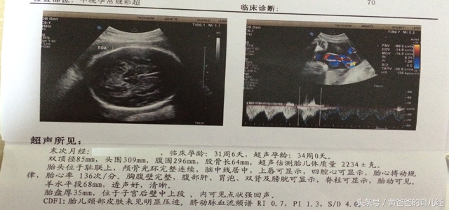 孕期想检查羊水是否正常,孕期看化验单