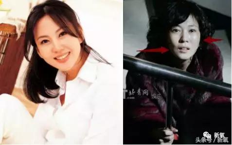 曾陷入小三、被*养包**传闻的女神公开承认整形，依然吊打少女幂和糖