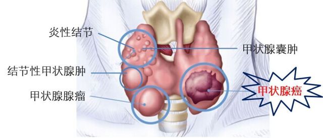 甲府事件有哪些,甲府市在哪里