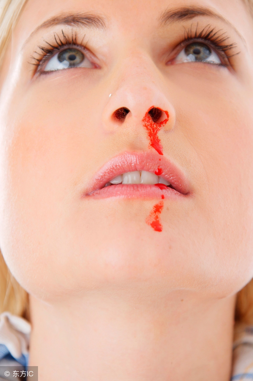 春季干燥流鼻血喝什么茶,春季干燥孩子流鼻血怎么办