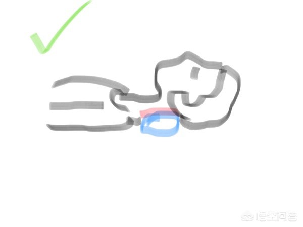 脖子短脖子下面有富贵包怎么办,脖子后面有个富贵包怎么锻炼