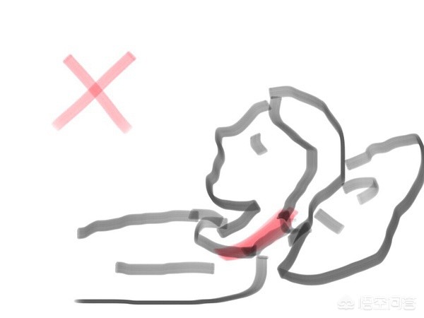 脖子短脖子下面有富贵包怎么办,脖子后面有个富贵包怎么锻炼