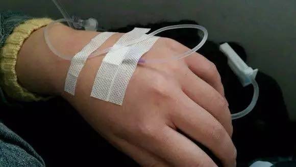 肩手综合征康复干预方法,肩手综合征康复治疗