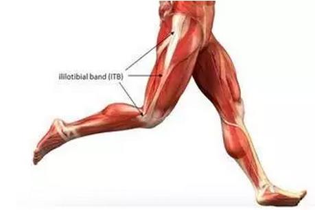 髂胫束综合征是哪里疼,髂胫束疼可以用筋膜枪吗