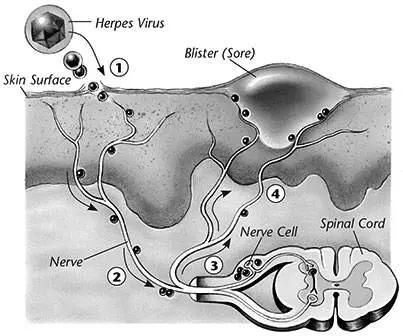 怀孕发现生殖道疱疹