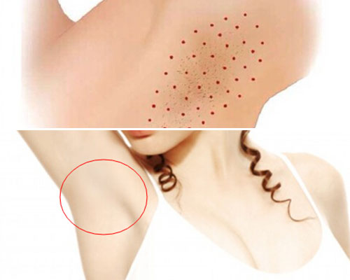 夏季腋下出汗多怎么办防汗小妙招,夏季汗出多了怎么办