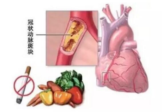 安钢总医院名医系列推送活动之——血汗管内科专家李东旺