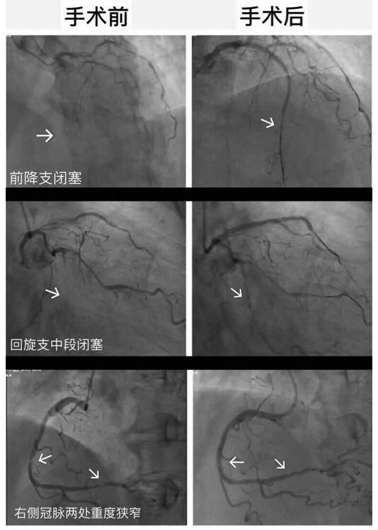 安钢总医院名医系列推送活动之——血汗管内科专家李东旺