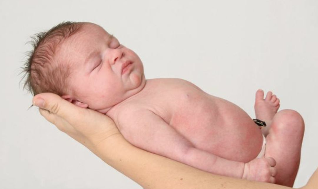 新生儿为何有黄疸消退只用四招,新生儿退黄疸的方法和步骤