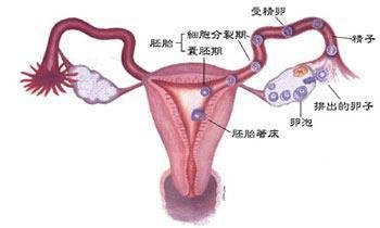 多囊卵巢综合症怎样治,关于多囊卵巢综合症如何治疗