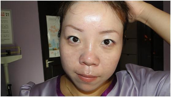 淡化斑点你还在为斑点烦恼吗,斑点的原因和改善方法