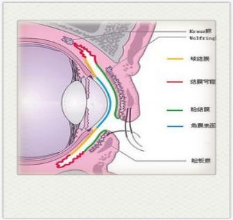 红眼痛怎么回事,不疼不痒眼睛肿是怎么回事