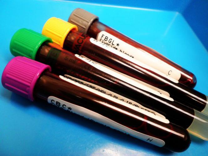 腰疼是不是肾有毛病啊,腰疼腰弯了有事吗