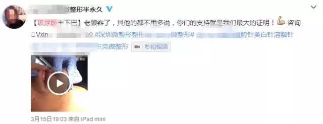 技术贴的正确贴法视频,技术贴如何快速撤下来