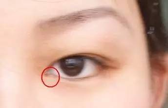 爱眼日|眼睛不适提醒你的11种病！