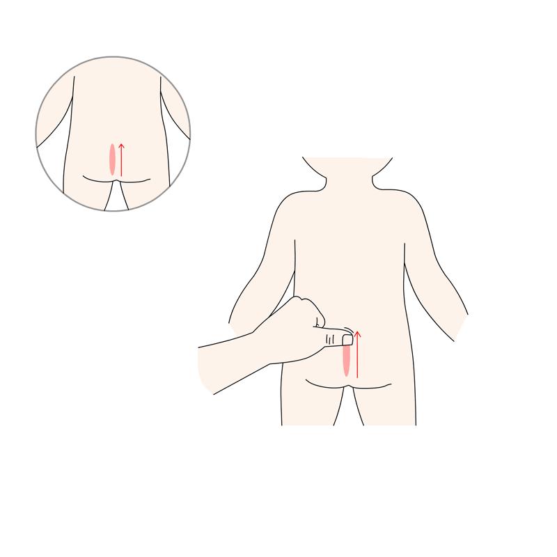 中医推拿小儿呕吐,小儿伤食呕吐艾灸哪里