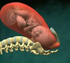 顺产外阴侧切和竖切有什么区别,顺产侧切还是挨刀好