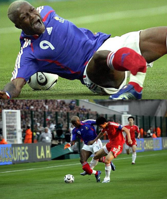 足坛最惨烈受伤,足坛令人悲伤的受伤瞬间