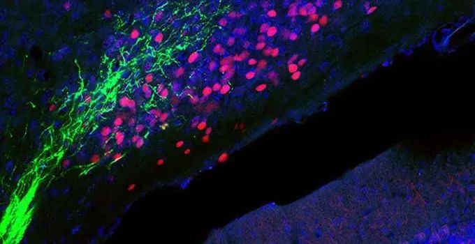 《细胞》：饥饿竟然能镇痛！科学家揭示相关神经通路，为非成瘾性镇痛药物开发带来新靶点｜科学大发现