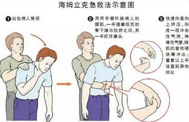 脑出血人指尖放血可以吗,脑出血针刺耳垂放血有用吗