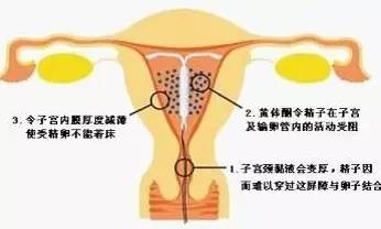 什么样的女性不适合上环,单身女性上环是什么心态