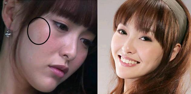 常见黑斑产生的6大因素，了解才能更好解决