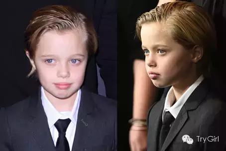 一些明星是不是整容了,明星整容会有后遗症吗