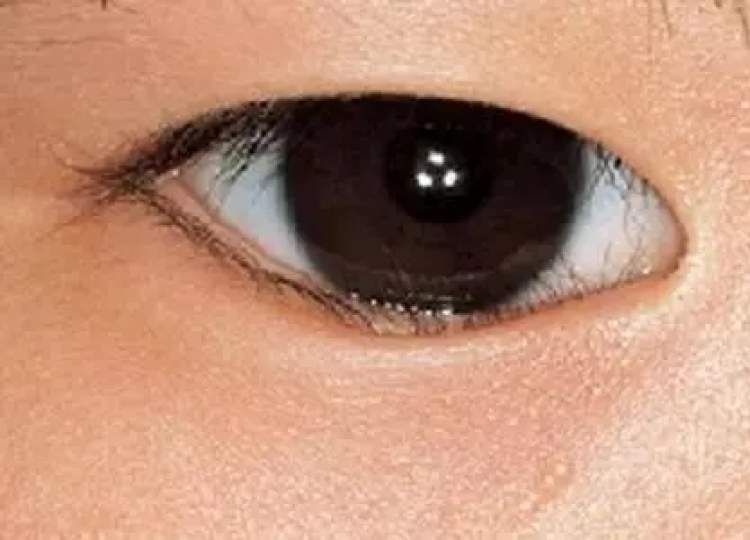 小孩眼红流泪有眼屎用什么滴眼液,孩子眼红有眼屎眼睛痒怎么办