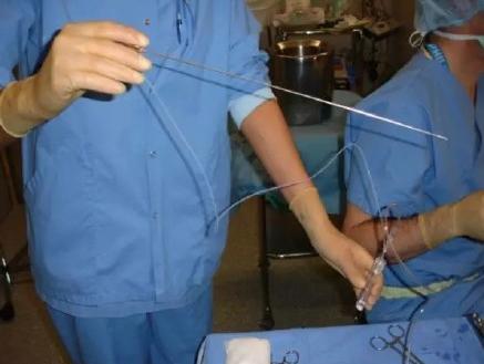 女大学生卖卵20颗赚3.5万最后住院这是违法买卖