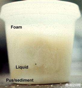 支气管扩张能彻底治好么,支气管扩张能彻底治好吗